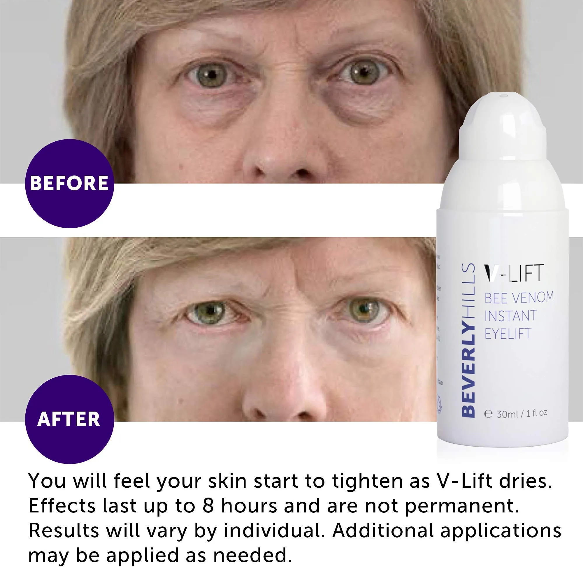 Beverly Hills V-Lift Instant Eye Lift and Eye Tuck Bee Venom Serum for Treating Puffy Eyes, Dark Circles, and Wrinkles