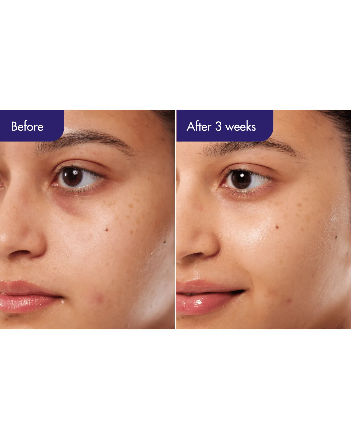 PDRN Caffeine Shot Serum