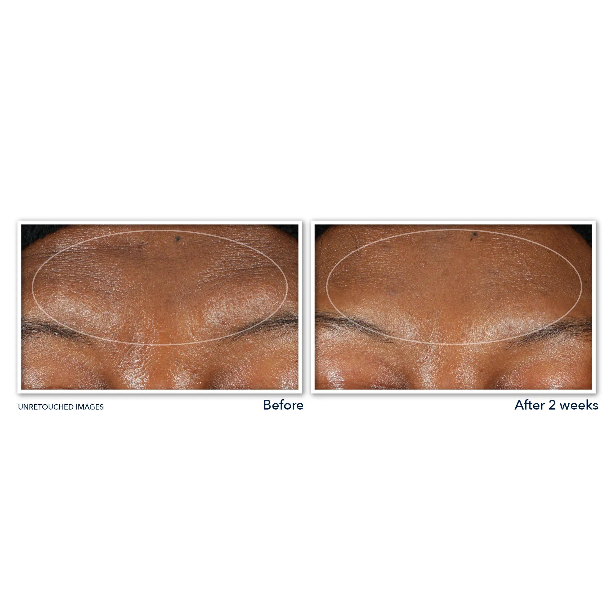 RETINOL CORREXION® Deep Wrinkle Serum Cleanser